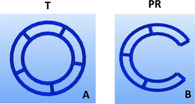 Development of tissue-engineered tracheal scaffold with refined mechanical properties and vascularisation for tracheal regeneration